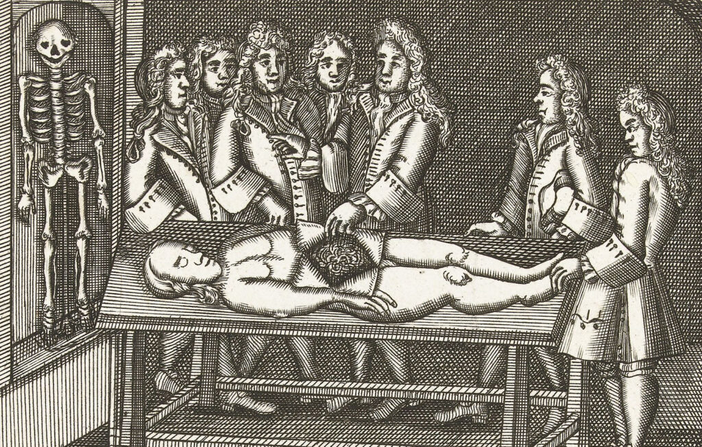 Men in 18th-century clothing watching a dissection