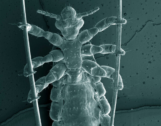 head louse holding hair strands