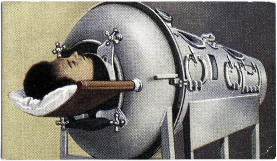 Illustration showing a man with brown hair lying inside a large gray metal tube. The top of his head is visible.