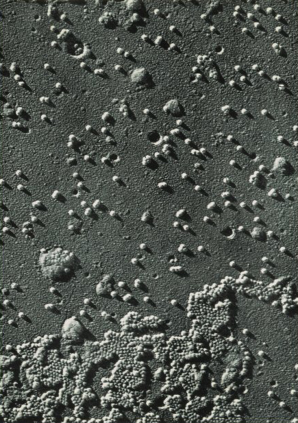 Small clusters of gray and white bumps on a dark gray surface