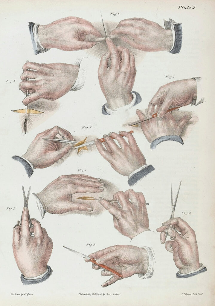 Drawing of hands and surgical instruments showing techniques