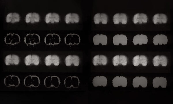 images of the brain from an MRI