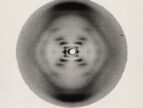 An X-ray diffraction photo of DNA labeled "Structure B," with handwritten notes referencing Rosalind Franklin.