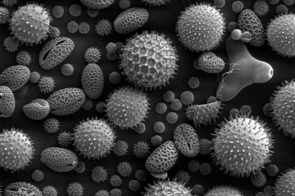 Black and white image of plant pollen under magnification